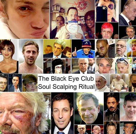 Unveil the Secrets of the Blackeye Club: Your Guide to Exclusive Membership
